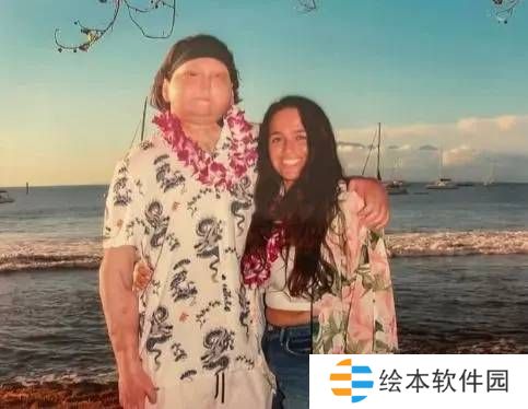 全球首例成功换脸换手男子 手术4年后宣布结婚